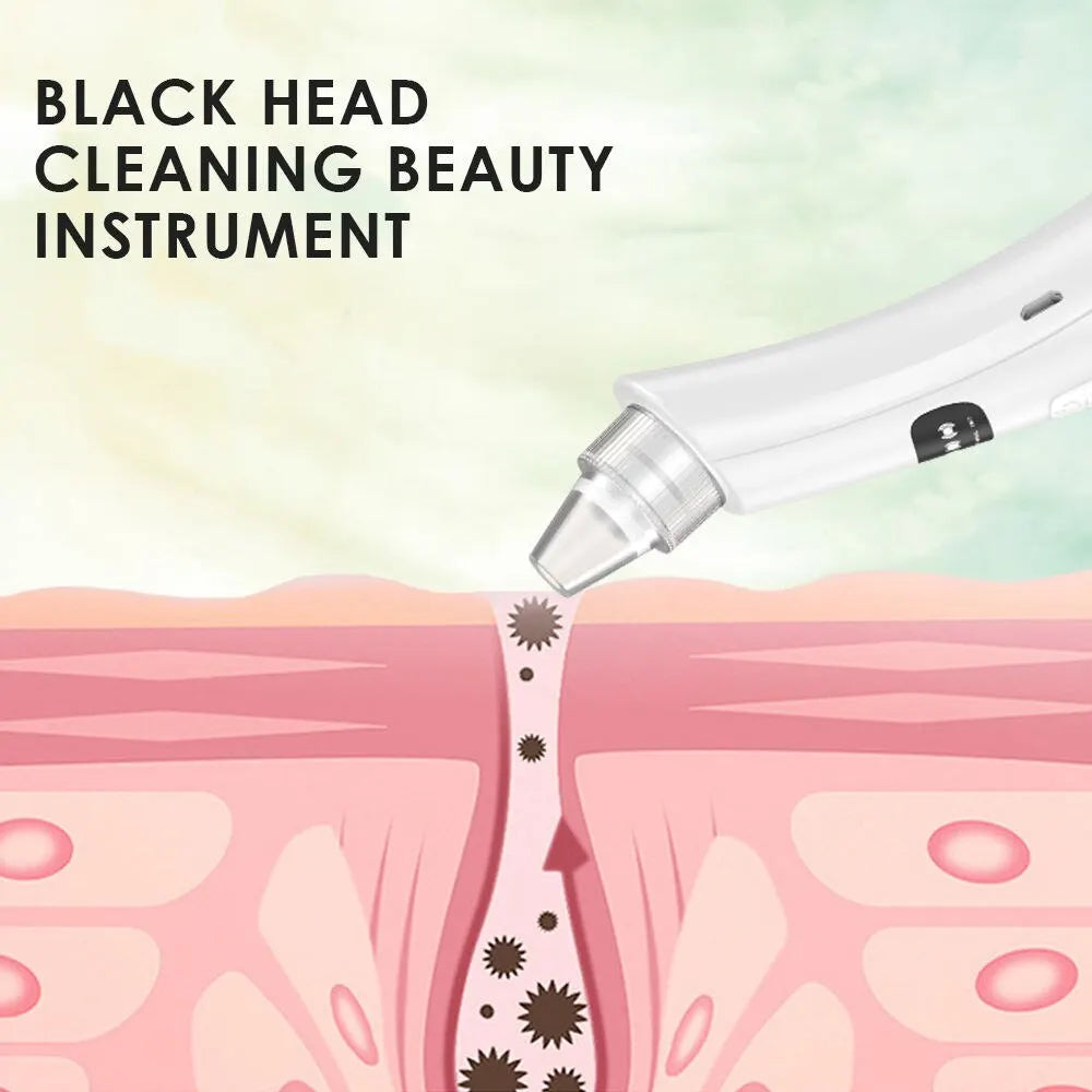 Cleansing Beauty Machine Dead Skin Remover Face Vacuum Blackhead Removal Skin